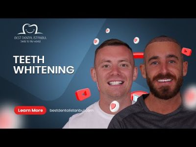 Teeth Whitening – Laser Bleaching